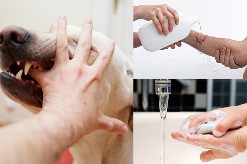 Bị chó cắn nên làm gì​